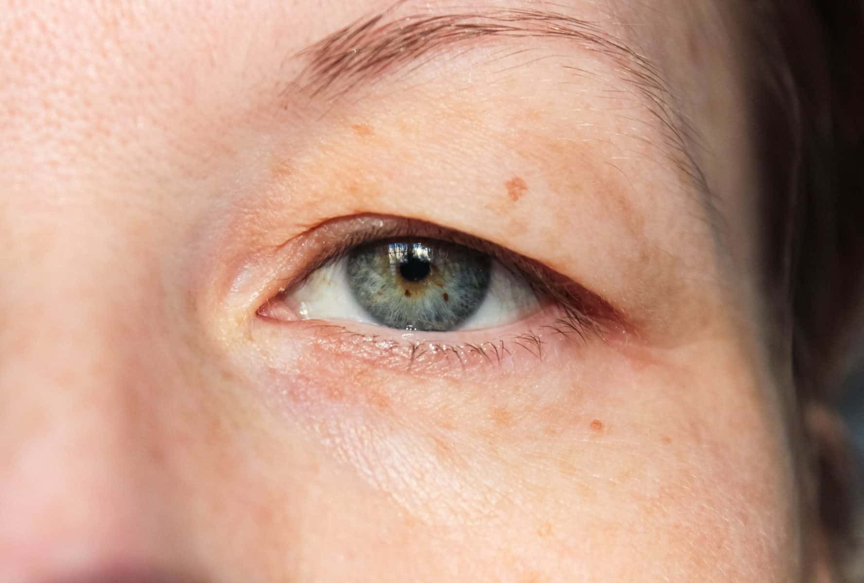ST6. 8 Signs on Your Face That Can Tell You Are Sick