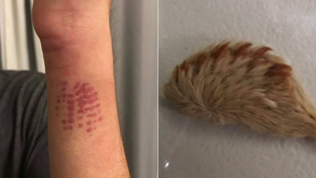 HT6. Beware of This Dangerous Caterpillar in Your Yard: What You Need to Know