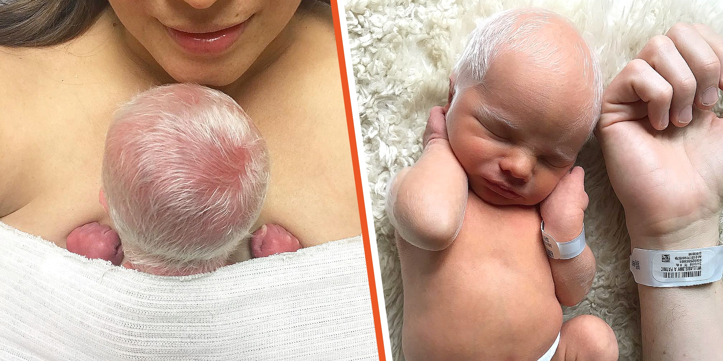 HT6. Baby mocked for having white hair – years later, he looks perfectly happy and healthy –