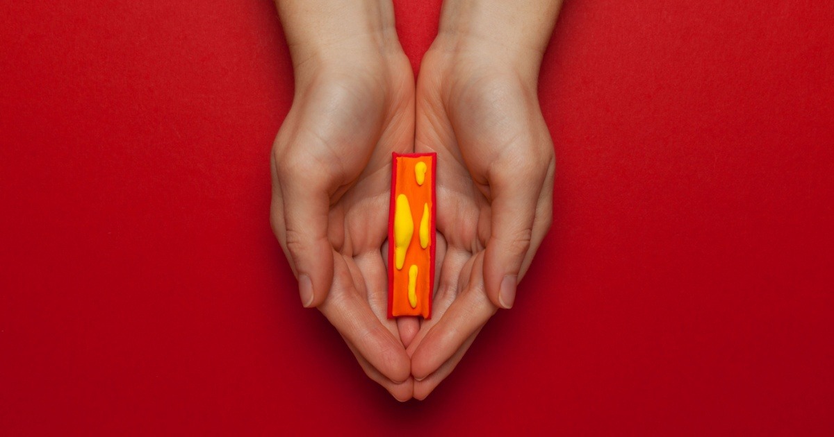HT6. 10 Signs You’re Living With Clogged Arteries