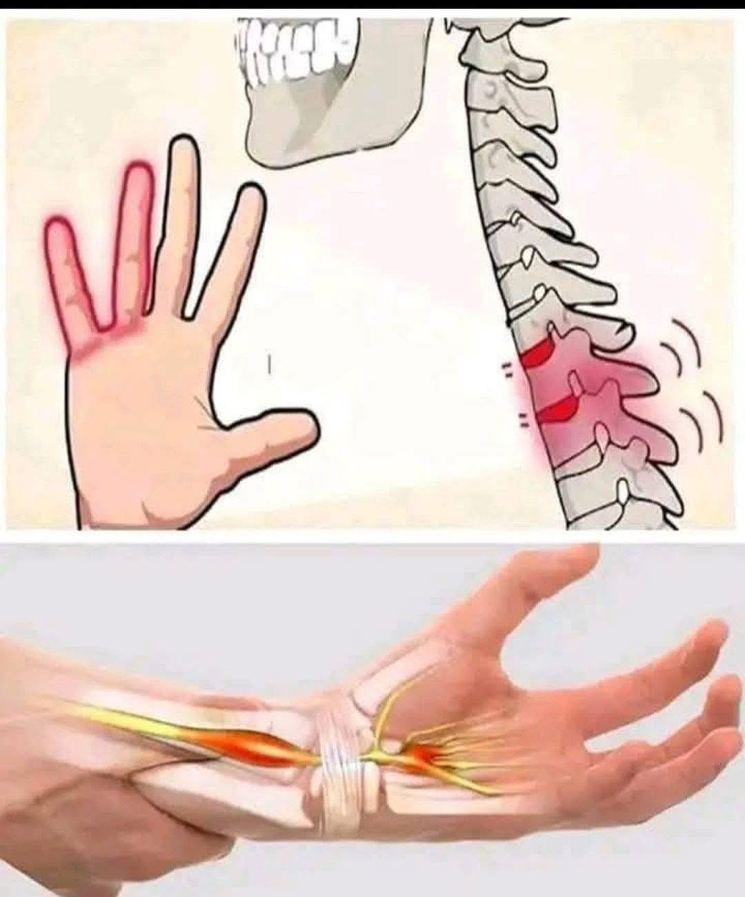 HT6. Numb Hands: Is It Normal or a Sign of a Problem?