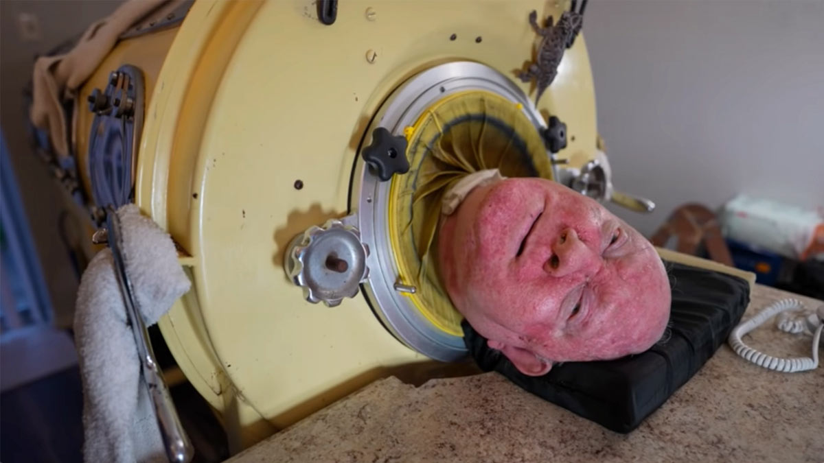 HT6. Paralyzed from polio at 6, he was one of the last people with an iron lung – but now there is a sad update