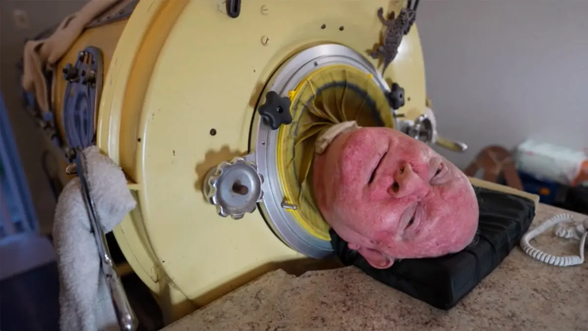 HT6. Paralyzed from polio at 6, he was one of the last people with an iron lung – but now there is a sad update