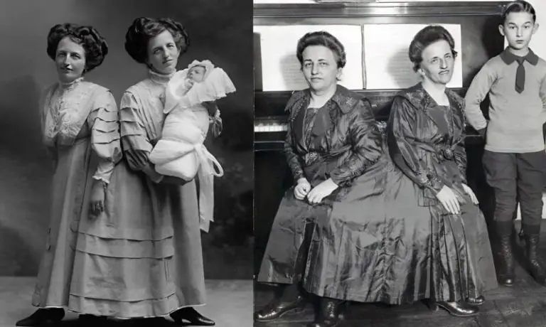 ST6. The Incredible Story of the Siamese Twins: One Fell in Love, Had a Baby — and Both Became Mothers…