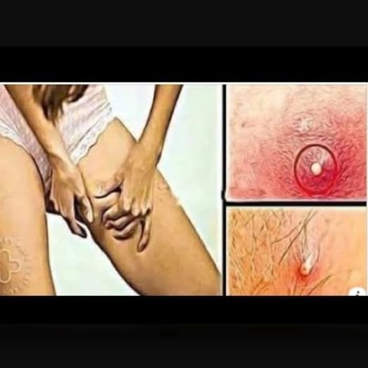 HT6. These are the signs that he is cr… See more