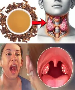 HT6. Got a Sore Throat? Try This Tiny Spice That Works Like Nature’s Antibiotic