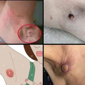 HT6. These are the signs that it’s no longer just sweat… See more