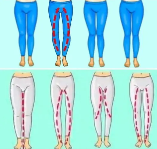 HT6. The Legs Of A Woman Can Say…