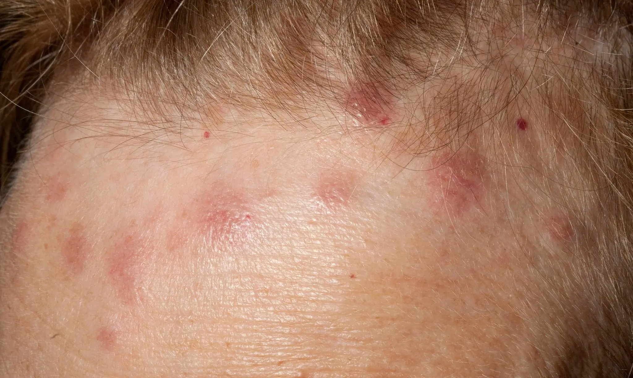 HT6. These are the signs that it is cre…See more