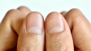 HT6. What does the half moon at the base of the nails mean?