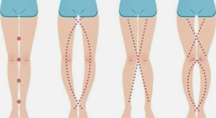 HT6. THE LEGS OF A WOMAN CAN SAY AS IT IS THEIR V*GIN