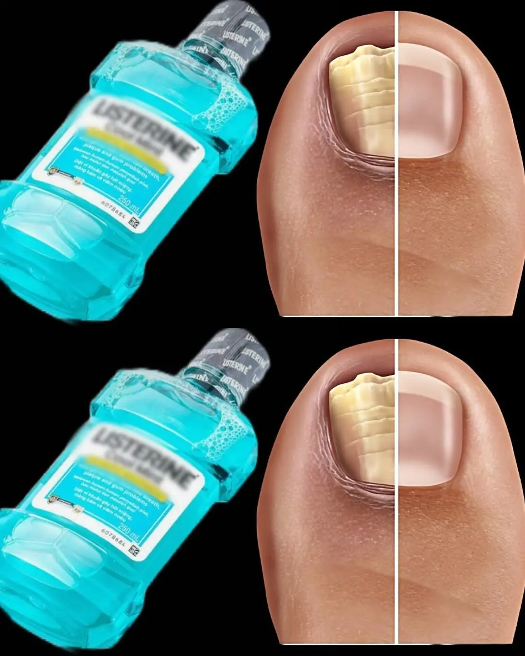 HT6. Say Goodbye to Nail Fungus with This Simple Home Remedy