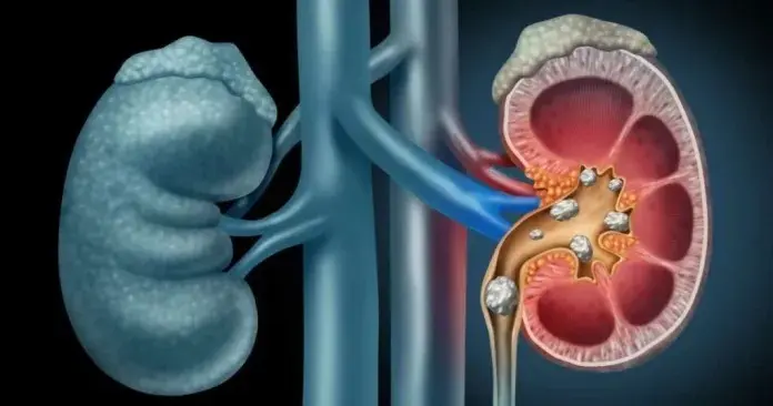 HT6. Warning Signs Your Kidneys Are in Danger – What to Watch For
