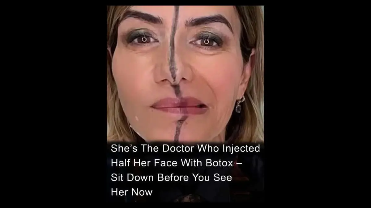 HT6. Doctor Injects Only Half Her Face With Botox—What Happened Next Might Surprise You