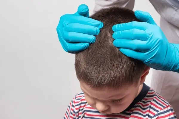 HT6. What to Do When Scalp Bumps Appear on Your Child: A Guide for Concerned Parents