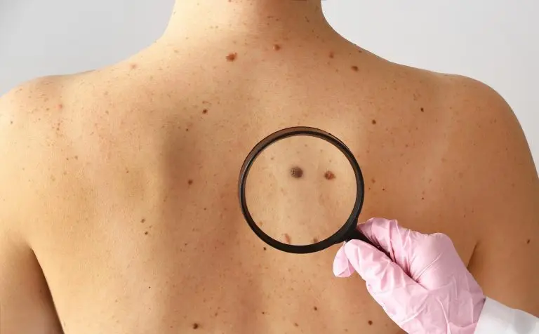 HT6. These are the signs that it’s gro…see more