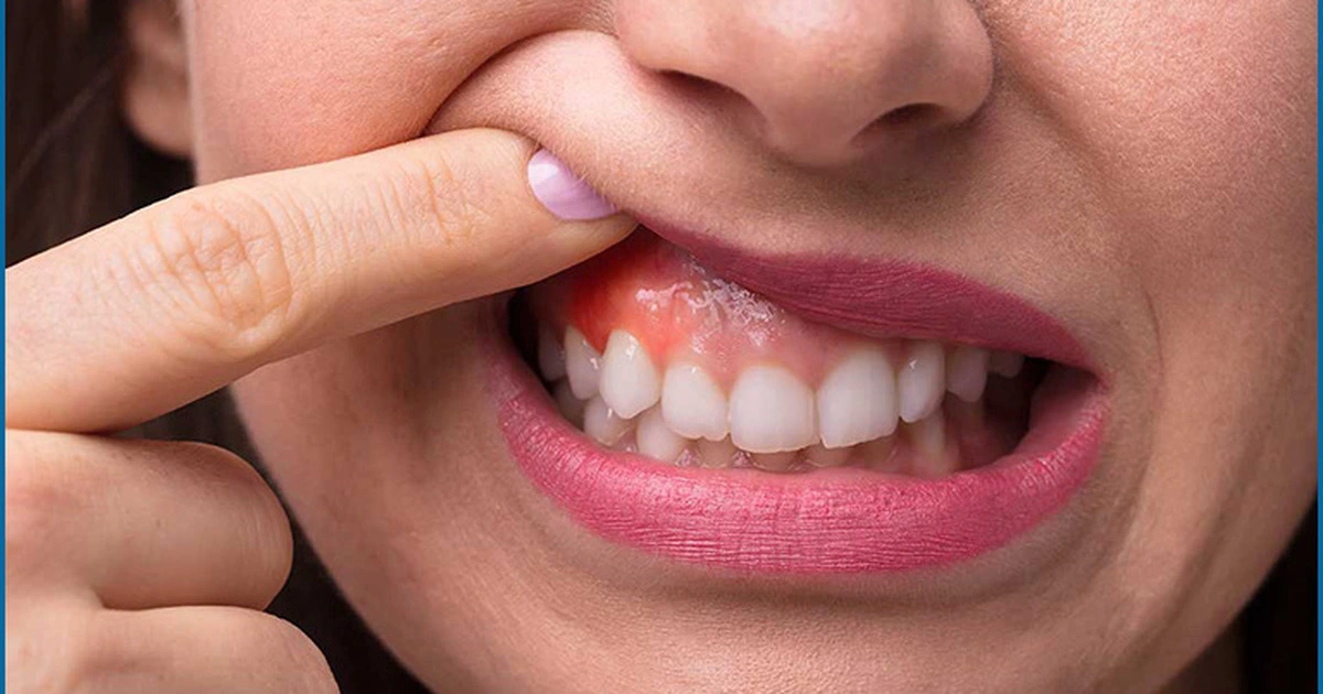 HT6. She drank what you probably drink… and and was finally diagnosed with ca… See more
