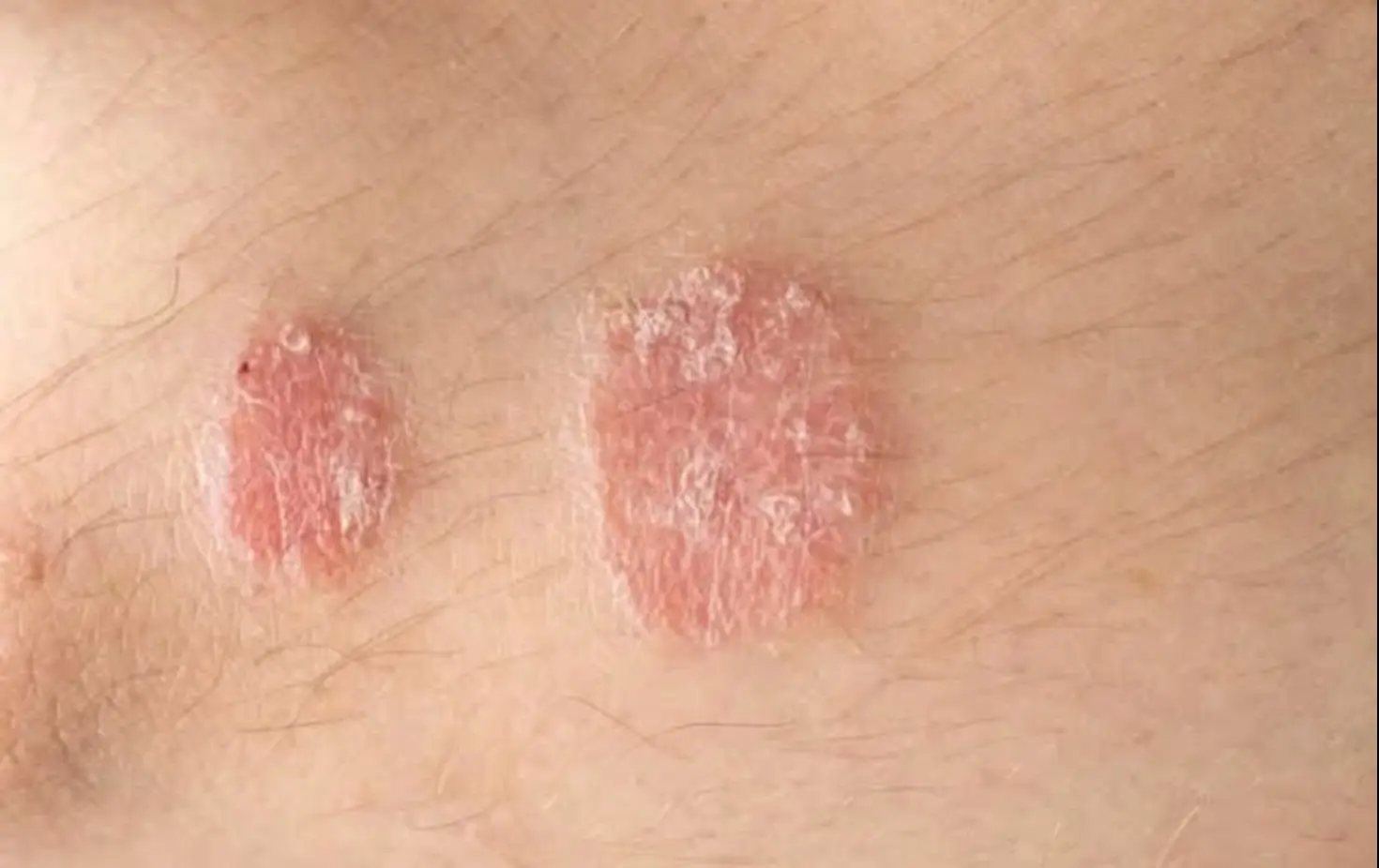 HT6. Warning signs you should never ignore on your skin