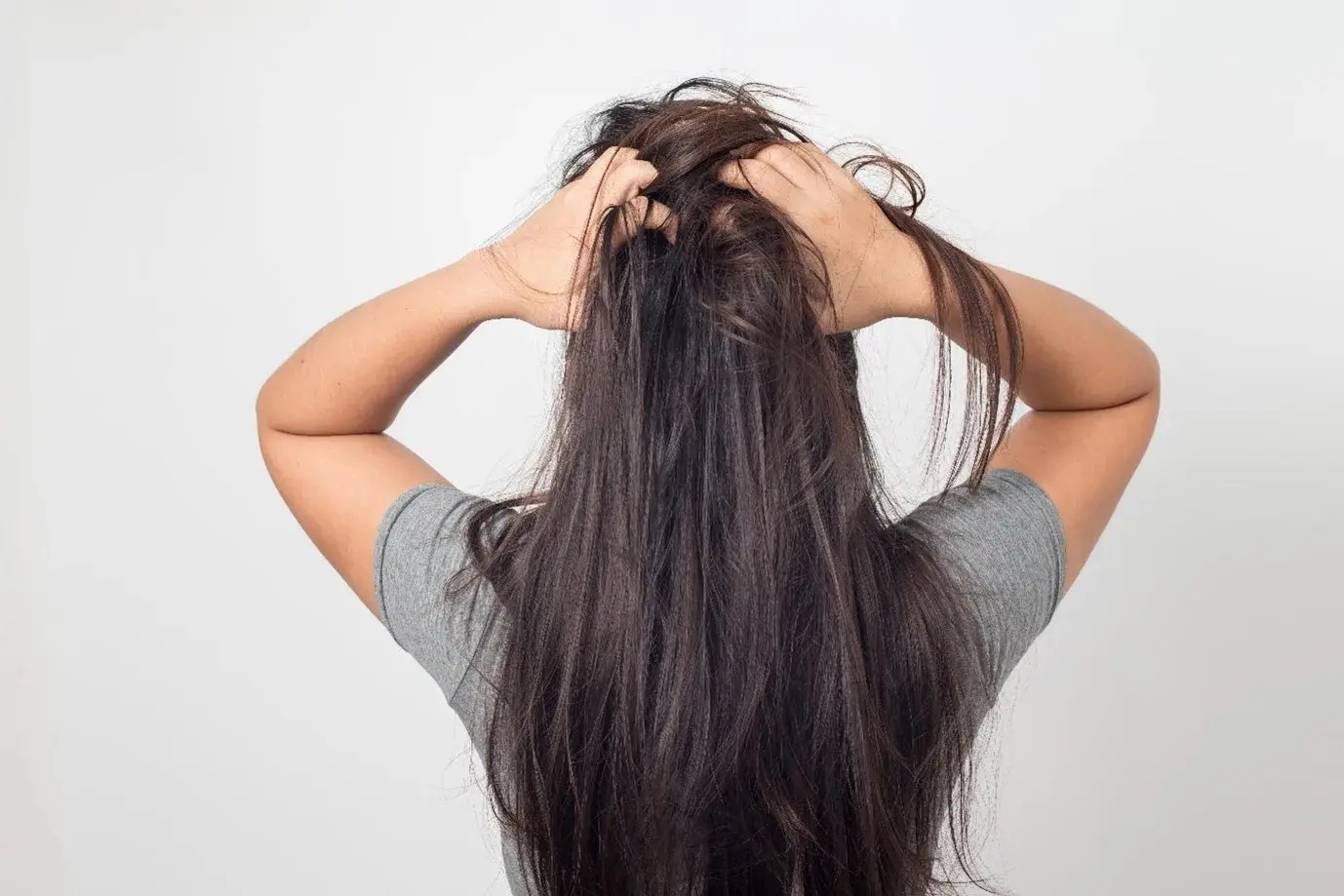 HT6. Itchy Head Won’t Go Away? Here’s What It Might Really Mean