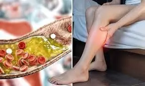 TE..How Your Feet Could Be Signaling Heart Problems and Clogged Arteries